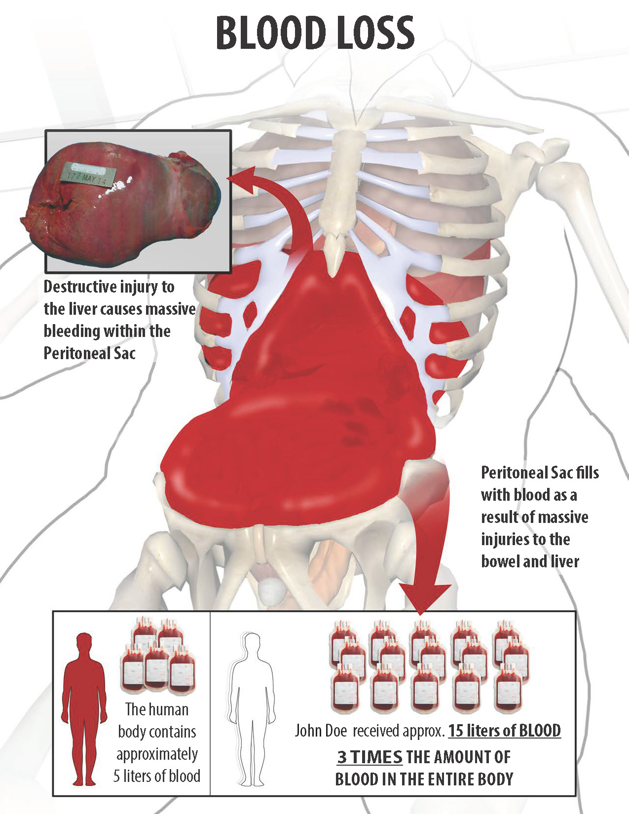 Injury Illustration_Page_3